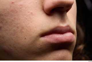 HD Face Skin Bryton cheek face lips mouth nose skin…